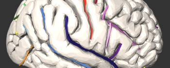 Image for Lateral Wall Sulci Model